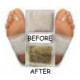 Detox Foot Pads Detox Foot Pads